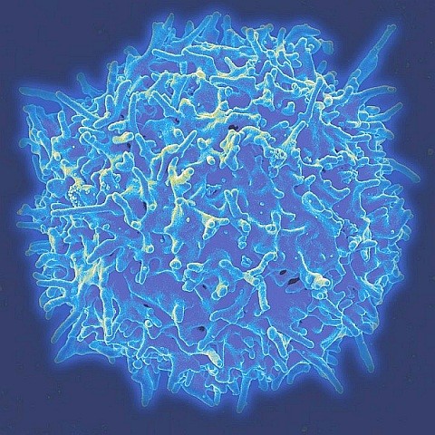 T-Zellen aktivieren, Immutherapie bei Prostatakrebs