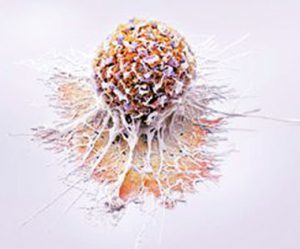 Prostatakrebs Zelle, kastrationsresistente Zellen